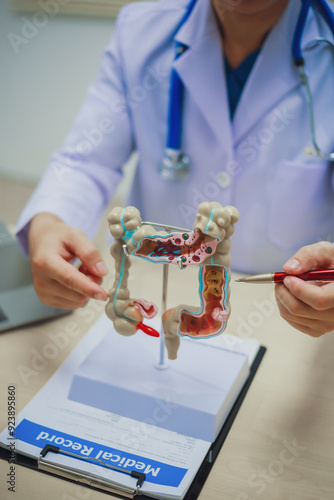 Colon surgeon holding anatomical model for diagnosis and treatment in hospital, intestinal diseases, stomach ulcers and intestinal modia.