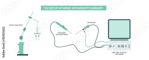 Wrist arthroscopy surgery