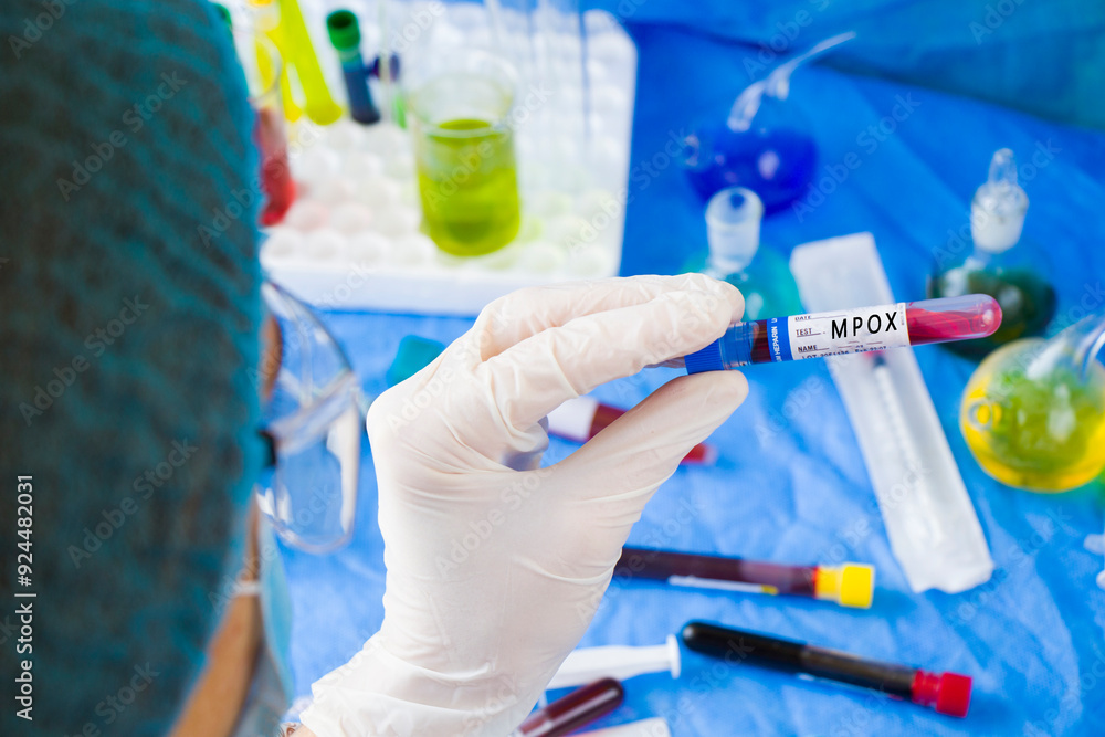 Mpox monkeypox virus Mpox monkeypox virus