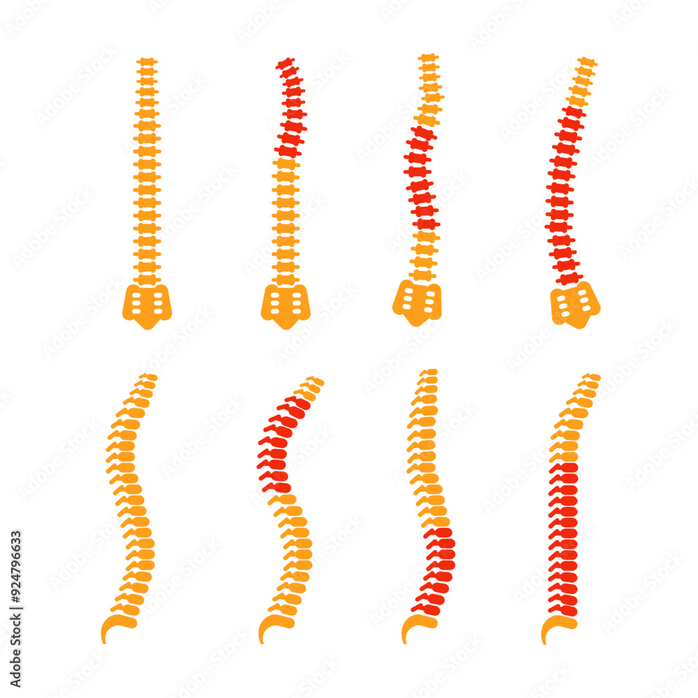 Comparing different human spine shapes with correct and incorrect posture, highlighting back pain areas Comparing different human spine shapes with correct and incorrect posture, highlighting back pain areas