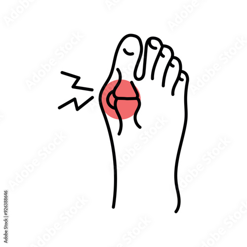 Psoriatic arthritis color line icon. Autoimmune diseases.