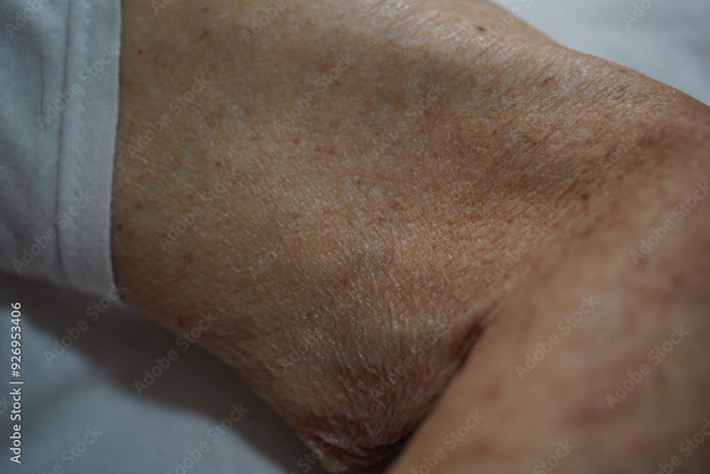 Naklejka premium Elderly hands and skin.