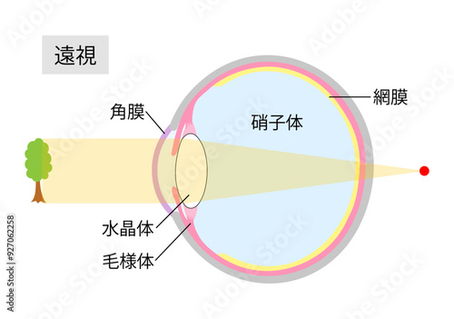 遠視のしくみをあらわした目の断面図2