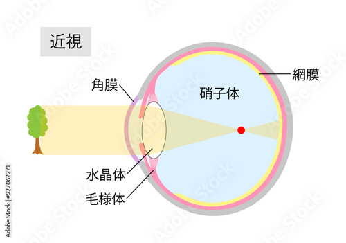近視の仕組みをあらわした目の断面図2