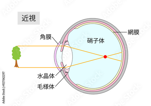 近視の仕組みをあらわした目の断面図1