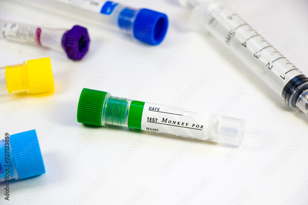 Chemical laboratory instruments, glassware and pipette. Tests and research diagnoses. Chemical laboratory instruments, glassware and pipette. Tests and research diagnoses.