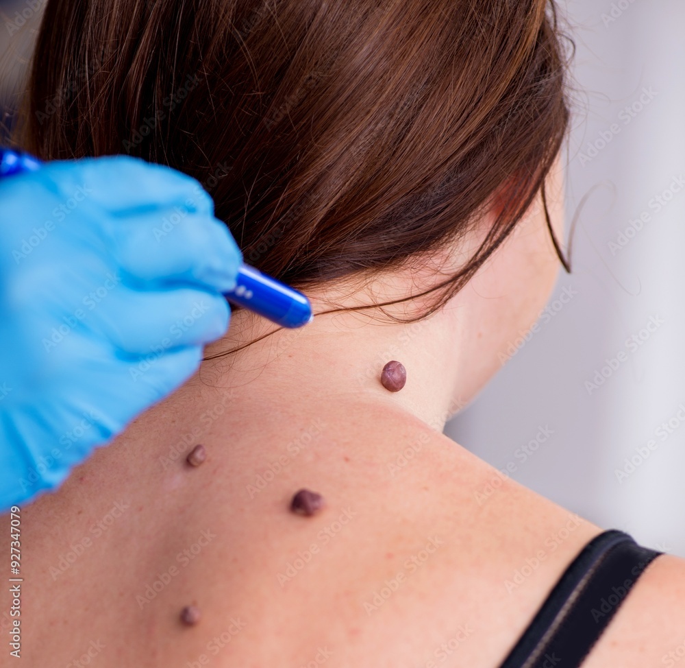 Young woman visiting male doctor dermatologist Young woman visiting male doctor dermatologist