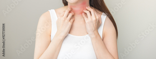 Dermatology concept, asian young woman, girl allergy, allergic reaction from atopic, insect bites on her neck, hand in scratching itchy, itch red spot or rash of skin. Health care, treatment of beauty photo