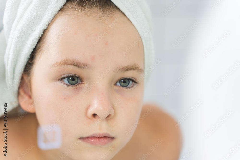 Little teenage girl, look in the mirror, the first pimples have appeared on her face. Problems of puberty. Little teenage girl, look in the mirror, the first pimples have appeared on her face. Problems of puberty.