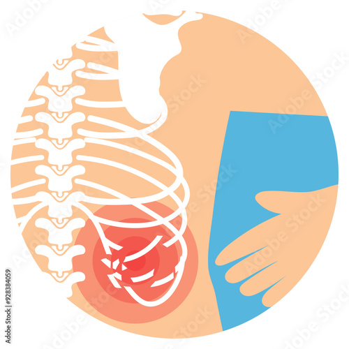Rib Cage Fracture Illustration