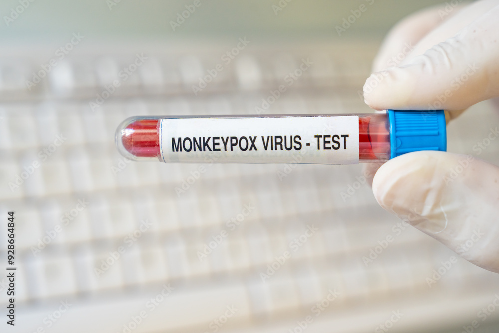 Fototapeta premium Monkeypox Virus (Maymun Çiçeği) Test Kit in the Lab Photo, Uskudar Istanbul, Turkiye (Turkey)