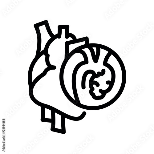 Ascending aortic aneurysm black line icon.
