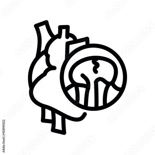 Mitral valve prolapse black line icon.
