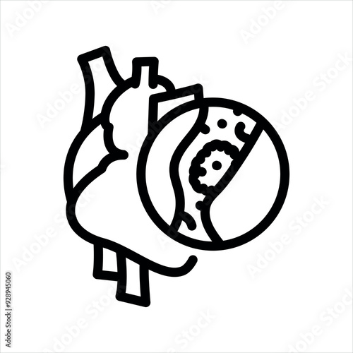 Thrombosis of the heart line black icon. Signs for web page