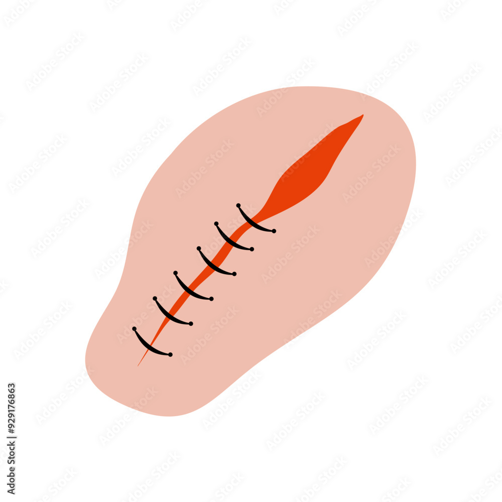Cut suture scar vector icon. First aid injury stitch skin concept wound Cut suture scar vector icon. First aid injury stitch skin concept wound