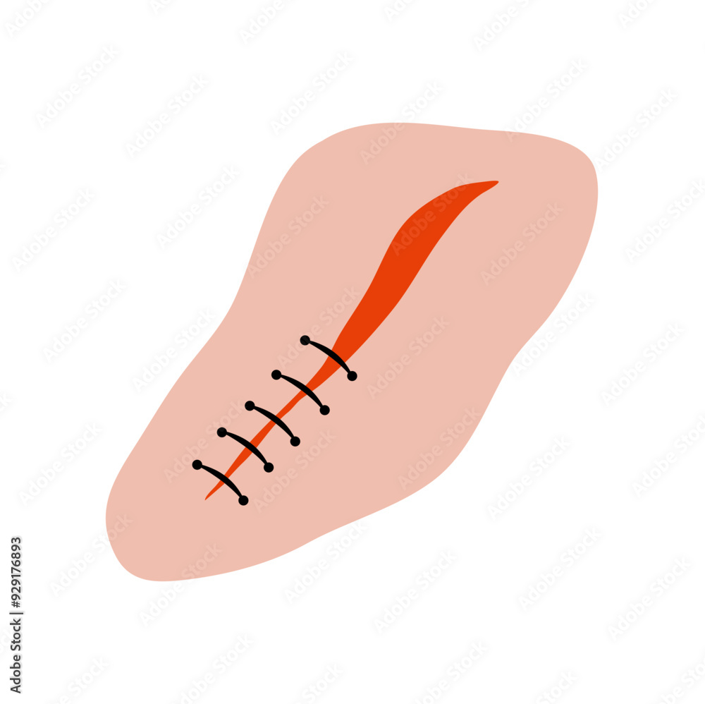 Cut suture scar vector icon. First aid injury stitch skin concept wound Cut suture scar vector icon. First aid injury stitch skin concept wound