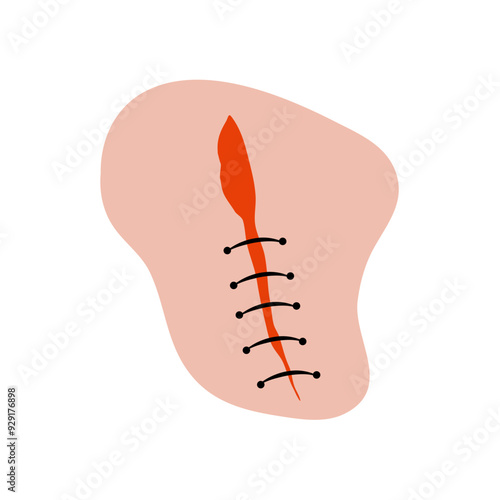 Cut suture scar vector icon. First aid injury stitch skin concept wound