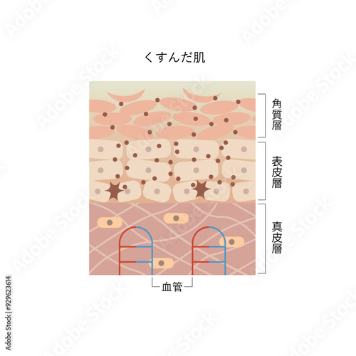 図版_肌図版_007_くすんだ肌