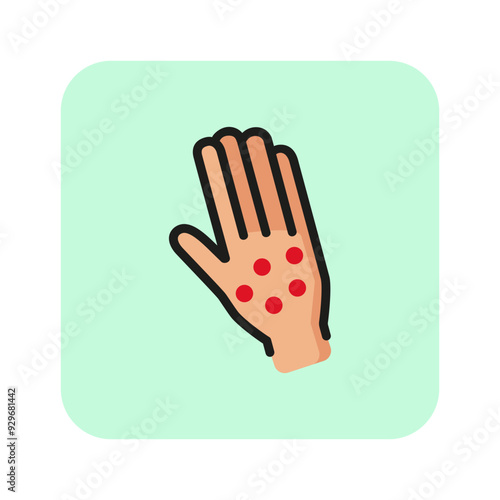 Skin rash line icon. Hand, itching, psoriasis. Cosmetology concept. Vector illustration can be used for topics like allergy, eczema, skin problem