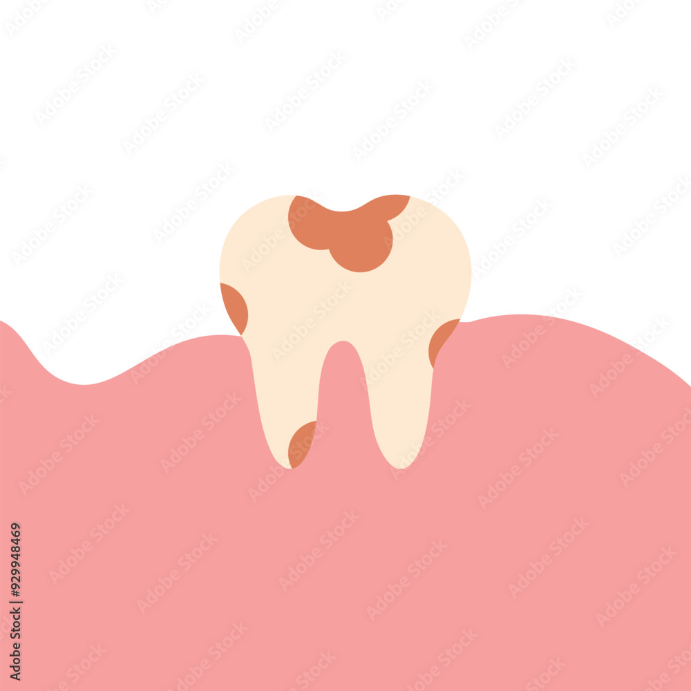 White decayed caries flat tooth icon. Vector tooth shape symbol. Oral medicine, stomatology, dental medicine concepts White decayed caries flat tooth icon. Vector tooth shape symbol. Oral medicine, stomatology, dental medicine concepts