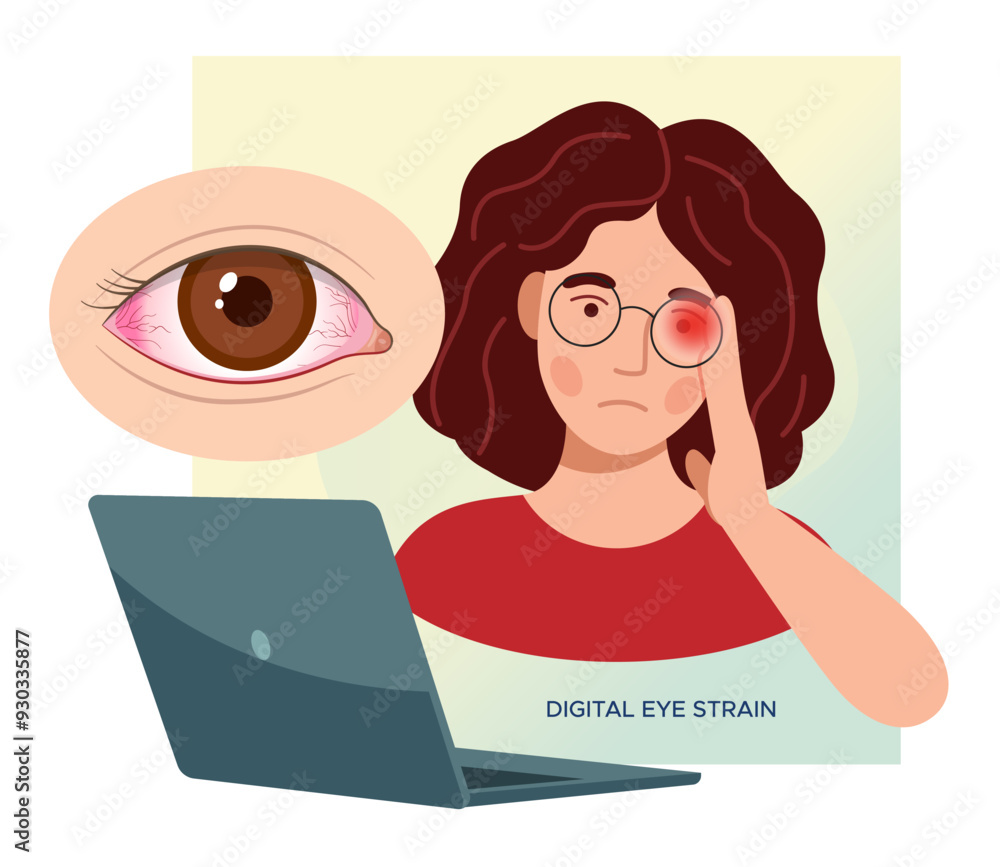 Digital Eye Strain, Person sitting on worktable with eye strain - Stock Illustration Digital Eye Strain, Person sitting on worktable with eye strain - Stock Illustration