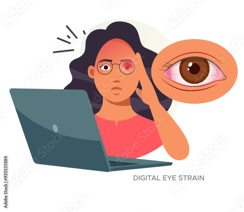 Digital Eye Strain, Person sitting on worktable with eye strain - Stock Illustration