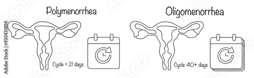 Polymenorrhea. Oligomenorrhea