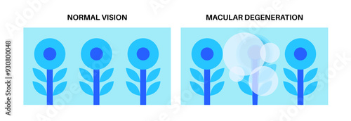 Macular degeneration poster