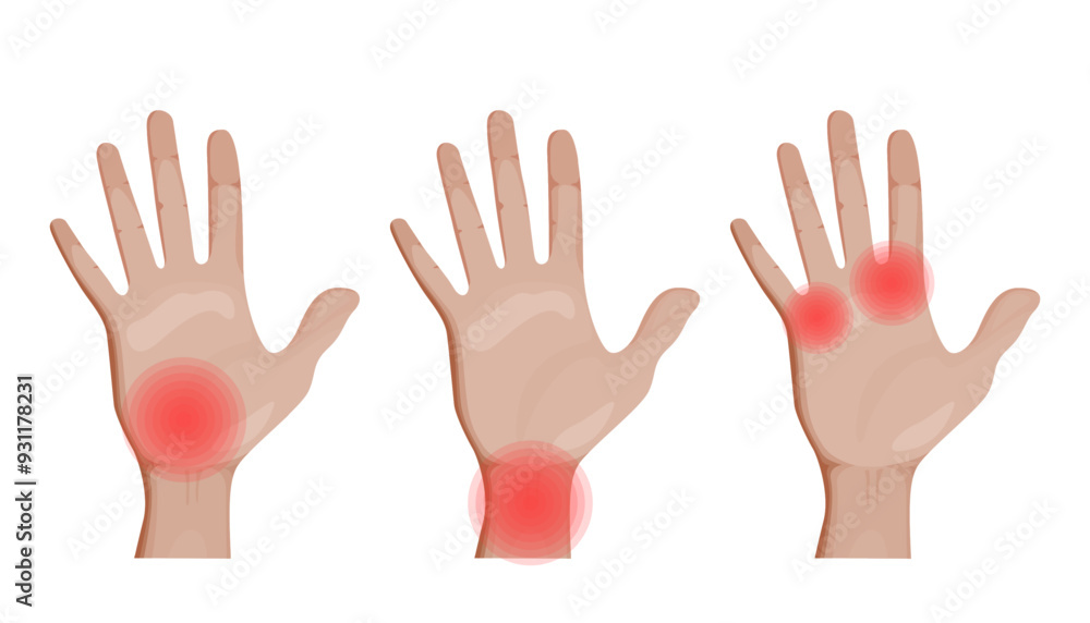 Hand, wrist and joint Pain Vector Illustration Hand, wrist and joint Pain Vector Illustration