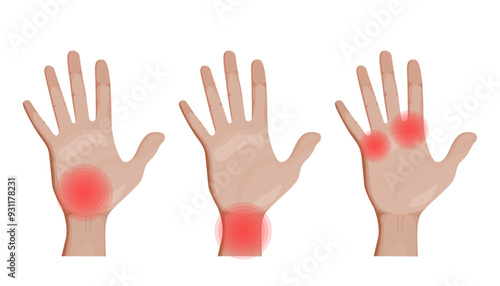 Hand, wrist and joint Pain Vector Illustration