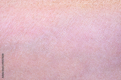 Photos dry and dehydrated human skin texture background