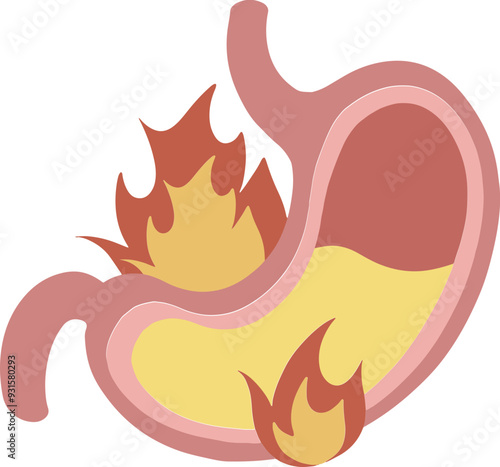 Heartburn colorful flat internal organs illustration