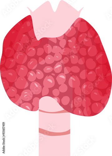 Thyroid disease Illustration 