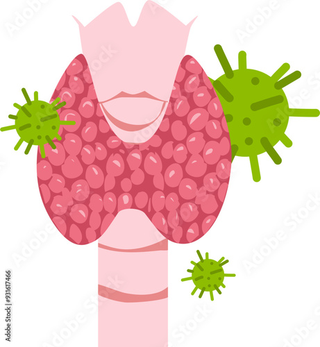 Thyroid disease Illustration 