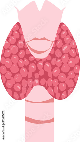 Thyroid disease Illustration 