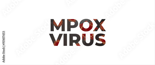 mpox virus 