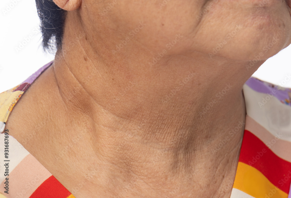 Fototapeta premium Neck wrinkles and lines of senior woman. Facial and Neck Skin Aging Change on senior woman.