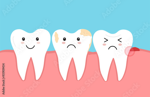 Tooth decay. Plaque terth. Dental caries. Toothache molar. Gum Recession. Vector illustration