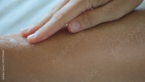 Female hand caressing dry skin on leg