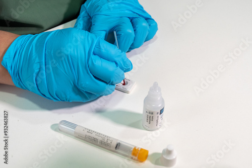 Personal de salud realizando un test rápido con una muestra de sangre, el mismo usa guantes de látex, sugiere un entorno clínico o de laboratorio. 