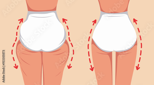  Slim body. Female body before and after. Massage and taping for weight loss for the thighs, remove the ears on the thighs. Vector template for advertising, website, banner, posters, cover