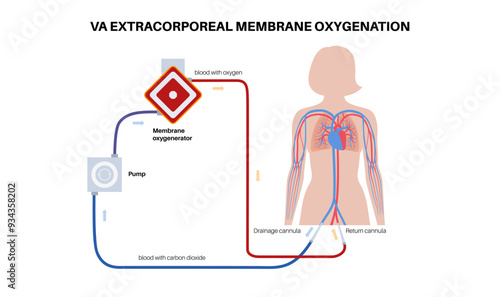 Extracorporeal membrane oxygenation