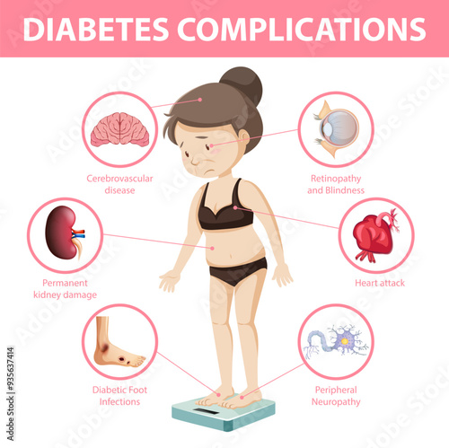 Diabetes complications information infographic