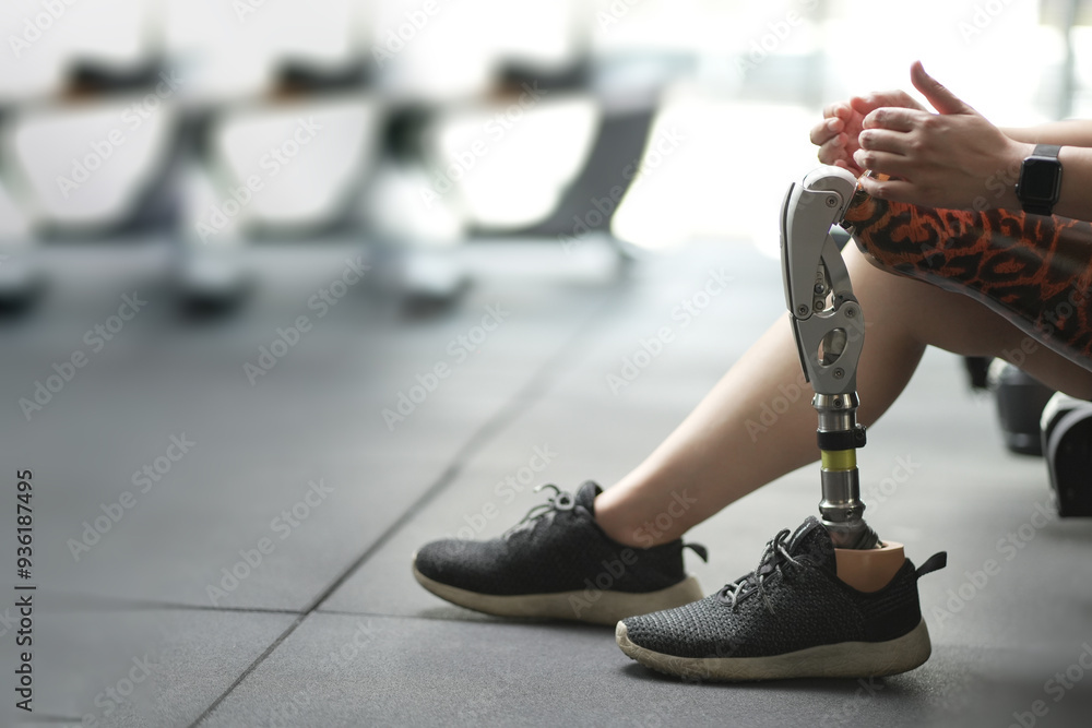 custom made wallpaper toronto digitalprosthetic, artificial leg. Woman with prosthetic leg using walking on treadmill while working out in gym. artificial leg. Woman wearing prosthetic equipment sit down after exercising in gym.