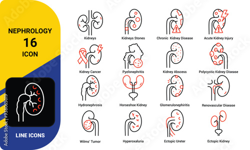 Common Nephrology diseases vector icon set. Line medical icons.