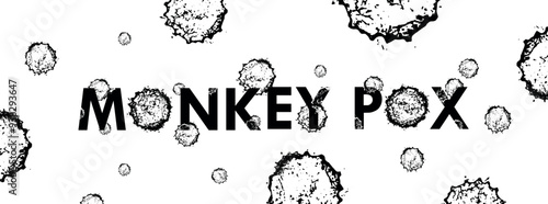 MONKEY POX sign	