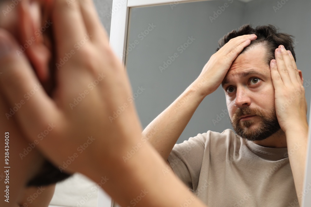 Man with hair loss problem looking at mirror indoors Man with hair loss problem looking at mirror indoors