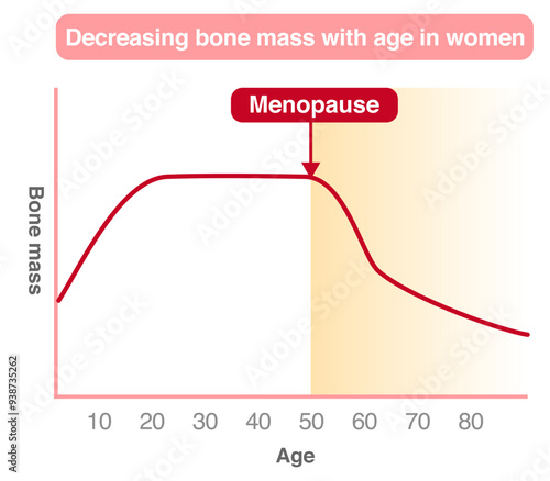 Graph of changes in bone mass by age in women, and the relationship between menopause and osteoporosis.