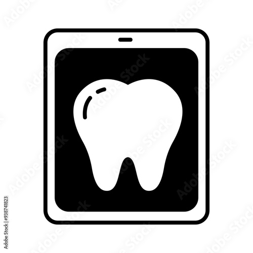 tooth with x ray