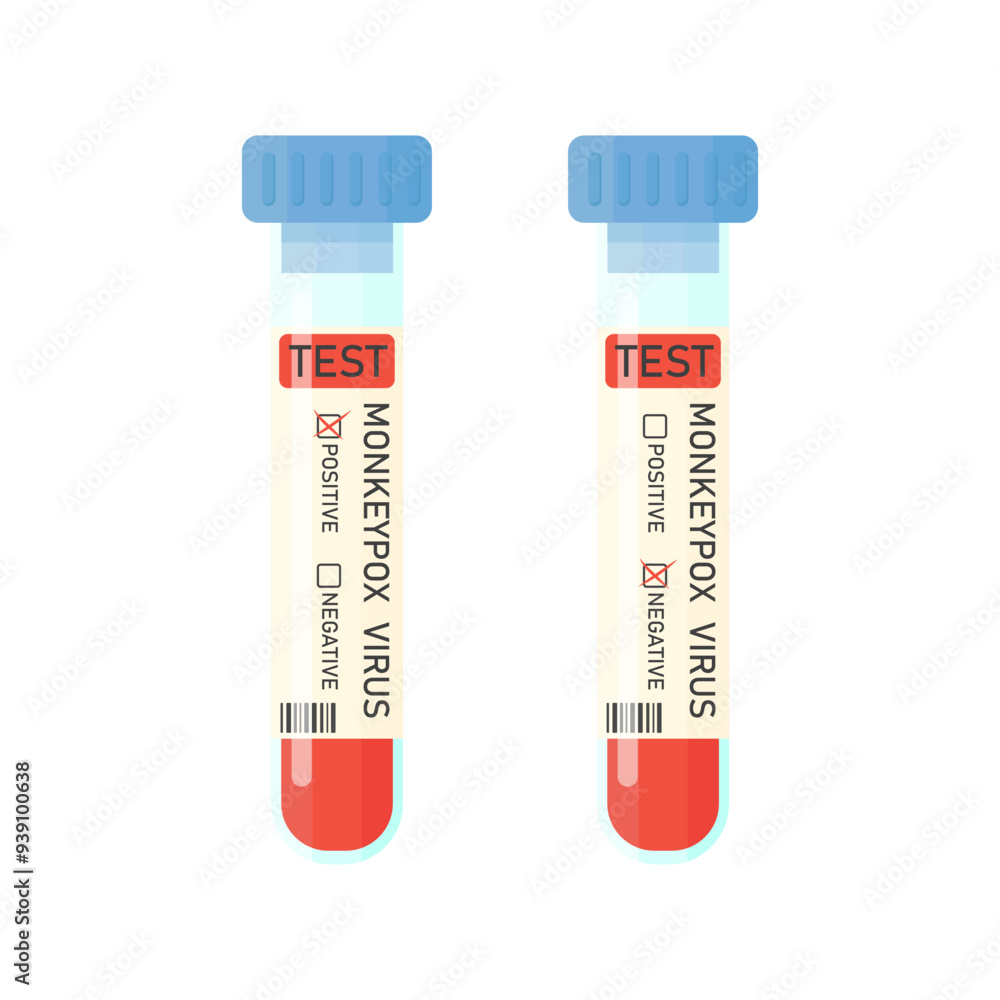 Blood test tubes for monkeypox virus test in cartoon style on a white background. Smallpox test. Positive and negative test for monkeypox virus. Monkeypox virus Blood test tubes for monkeypox virus test in cartoon style on a white background. Smallpox test. Positive and negative test for monkeypox virus. Monkeypox virus